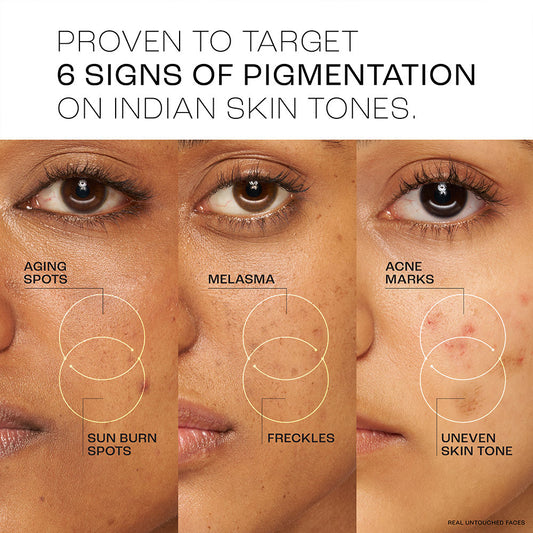 Lakmē Absolute Perfect Radiance Serum